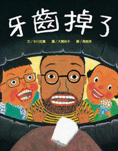 Load image into Gallery viewer, 牙齒掉了